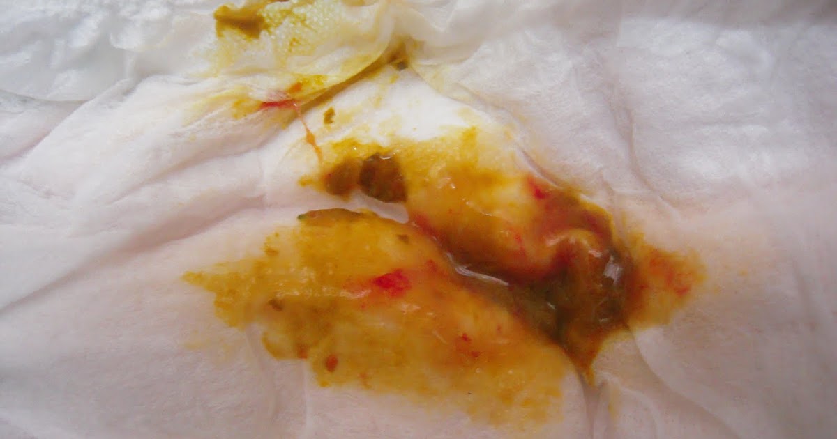2 Year Old Blood In Stool