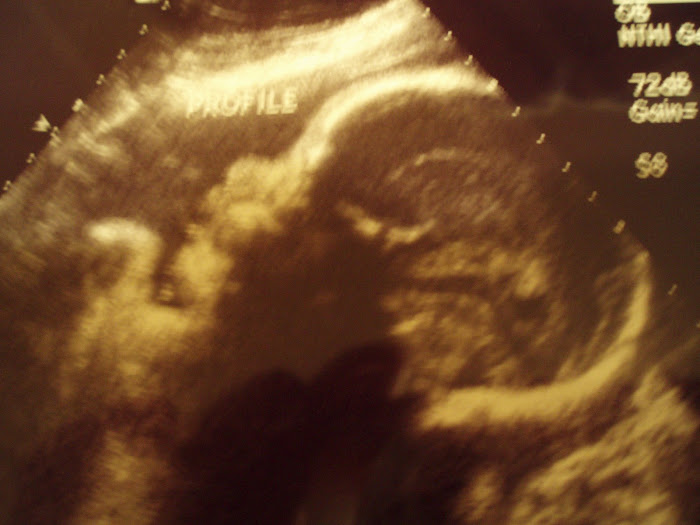 Riley's profile