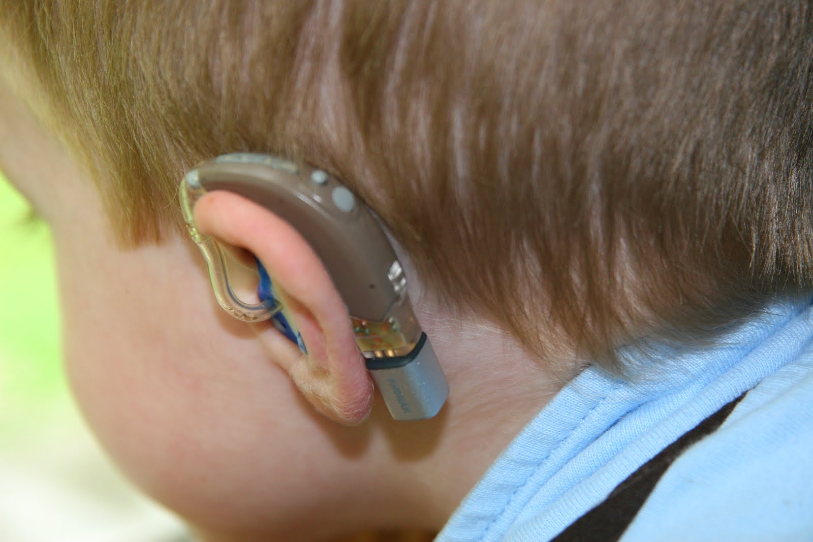 0 hearing. Аппарат для глухих кохлеарная имплантация. Аппарат Cochlear кохлеарный Cochlear. Слуховой аппарат Cochlear 8. Слуховой аппарат электроника у2.
