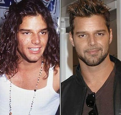 El Antes y Despues de la Estrellas - Ricky Martin