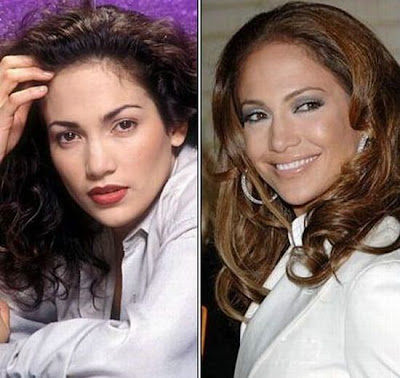 El Antes y Despues de la Estrellas - Jennifer Lopez