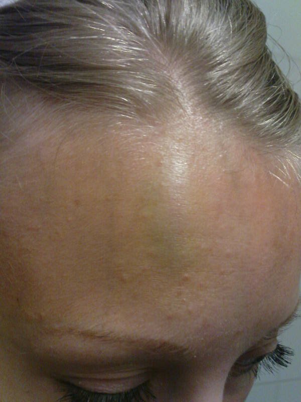 [image-upload-213-725458.jpg]