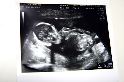 Eleven July 2009: Visit to Adelina Wong Clinic