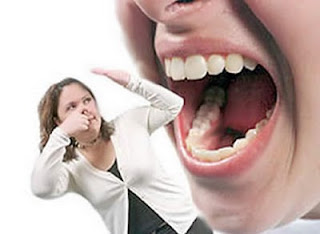 Halitosis - Odontología ABC Blog de odontología