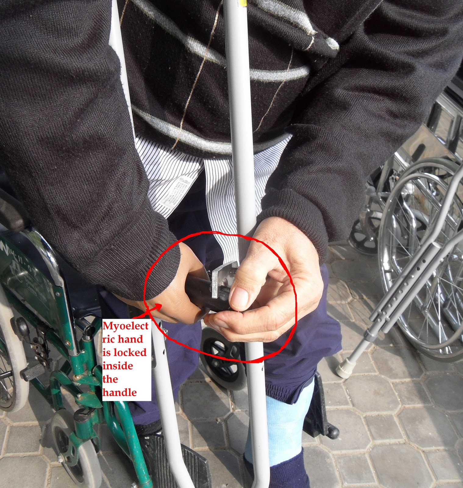 Spinal Cord Injuries Management & Assistive Technology Adapted