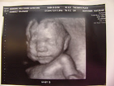 Baby B  25 weeks