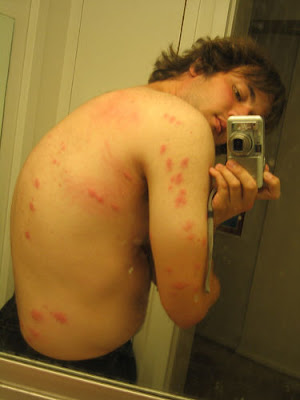 Want to know what do bed bug