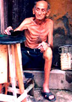 Anciano cubano con visibles síntomas de desnutrición
