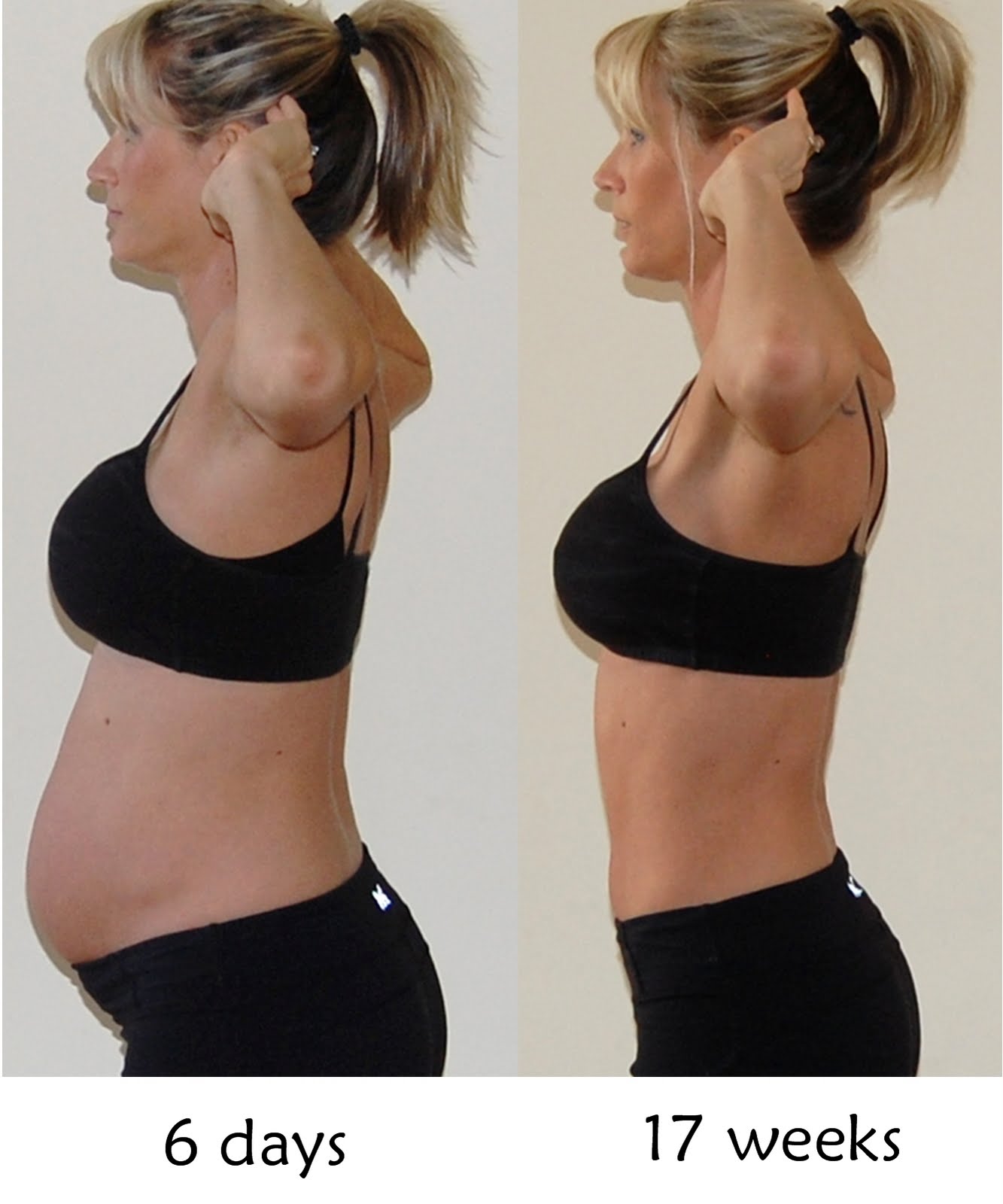 6 недель после родов. Живот до и после похудения. Живот у беременных вытянутый. Расслабленный живот. Планка для похудения после родов.