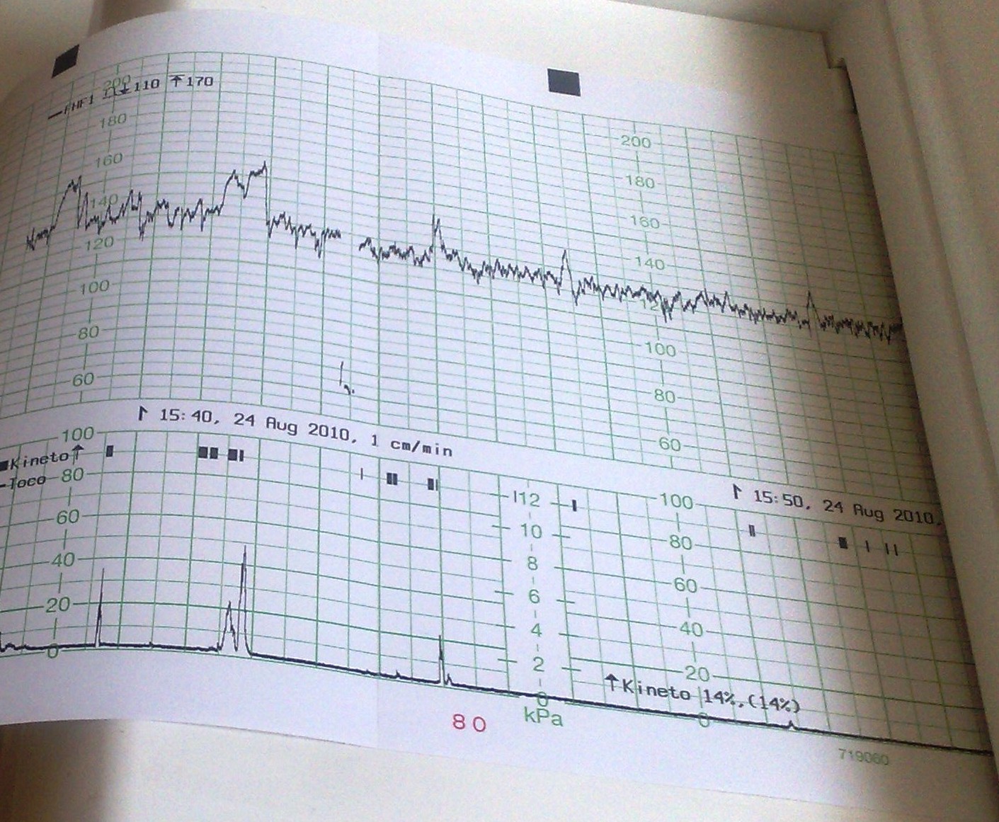 Ctg Wie Hoch Müssen Die Wehen Sein Isn Ding wa??: August 2010