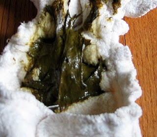 amniotic fluid in toilet