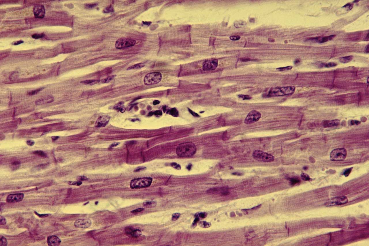 Клетка сердечной поперечно полосатой мышечной ткани. Гладкая мышечная ткань микропрепарат. Поперечно полосатая сердечная мышечная ткань микропрепарат. Ткань под микроскопом. Мышечная ткань под микроскопом.