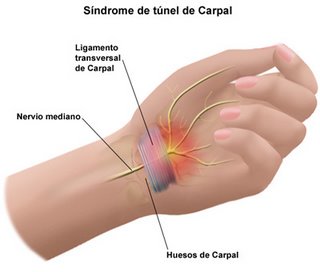 Por mano la noche una en hinchazón