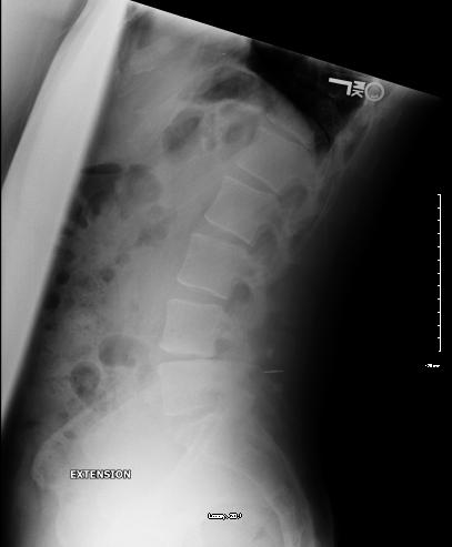 [Wilson+XRAY5+2010.JPG]