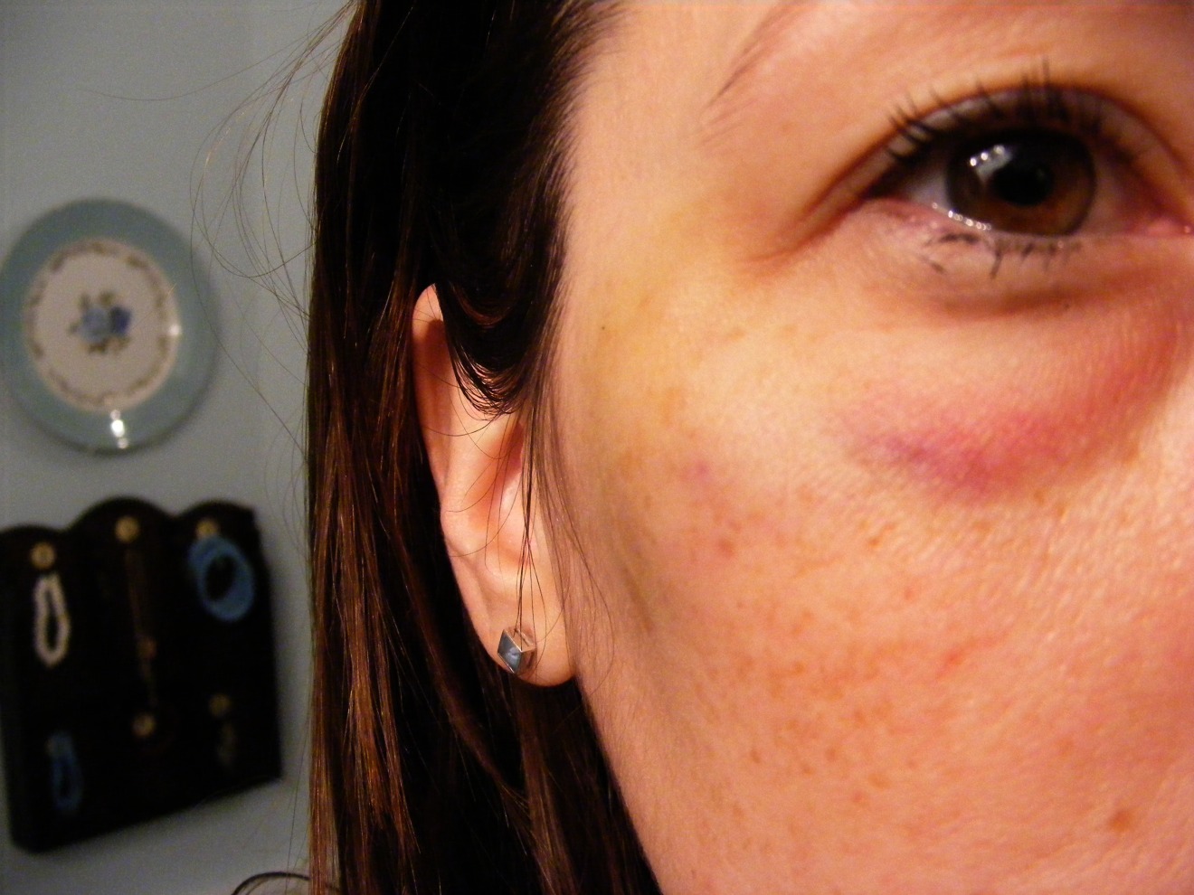 White Wood Black Eye