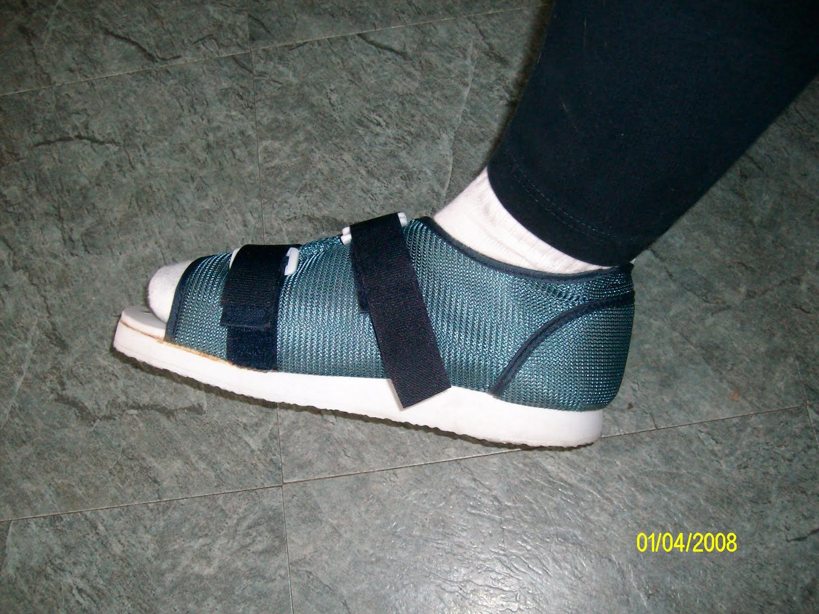 Pepper�s Horses Broken Toe