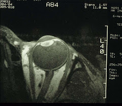 Hi-res MRI of the human eye