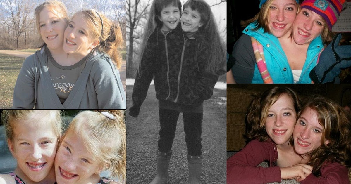 Abby and Britty Hensel Conjoined Twins: All Things Are Possible | JUAN PH