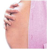 FIV para endometriose Reprodução assistida para endometriose