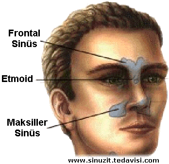 [sinuzit.gif]