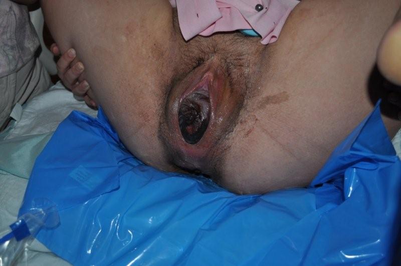 Vagina Giving Birth