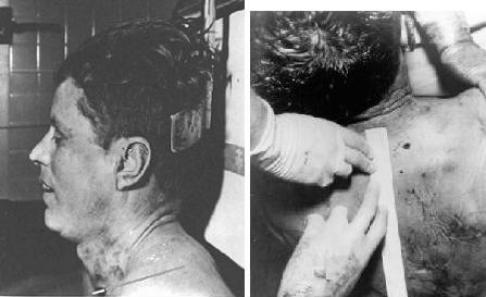 JFK-Autopsy-Photos.jpg