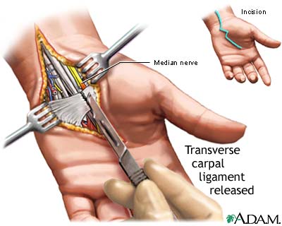 [CTSurgery.jpg]
