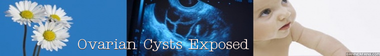 Ovarian Cysts Exposed