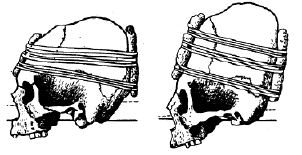 deformcraneana.gif