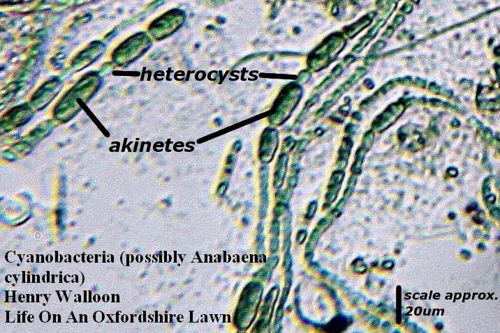 Nostoc Under Microscope Labelled