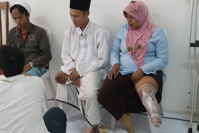 Baksos Pengukuran Kaki dan Tangan Palsu