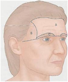 healthylifeandbeauty.com: Brow Lift Techniques