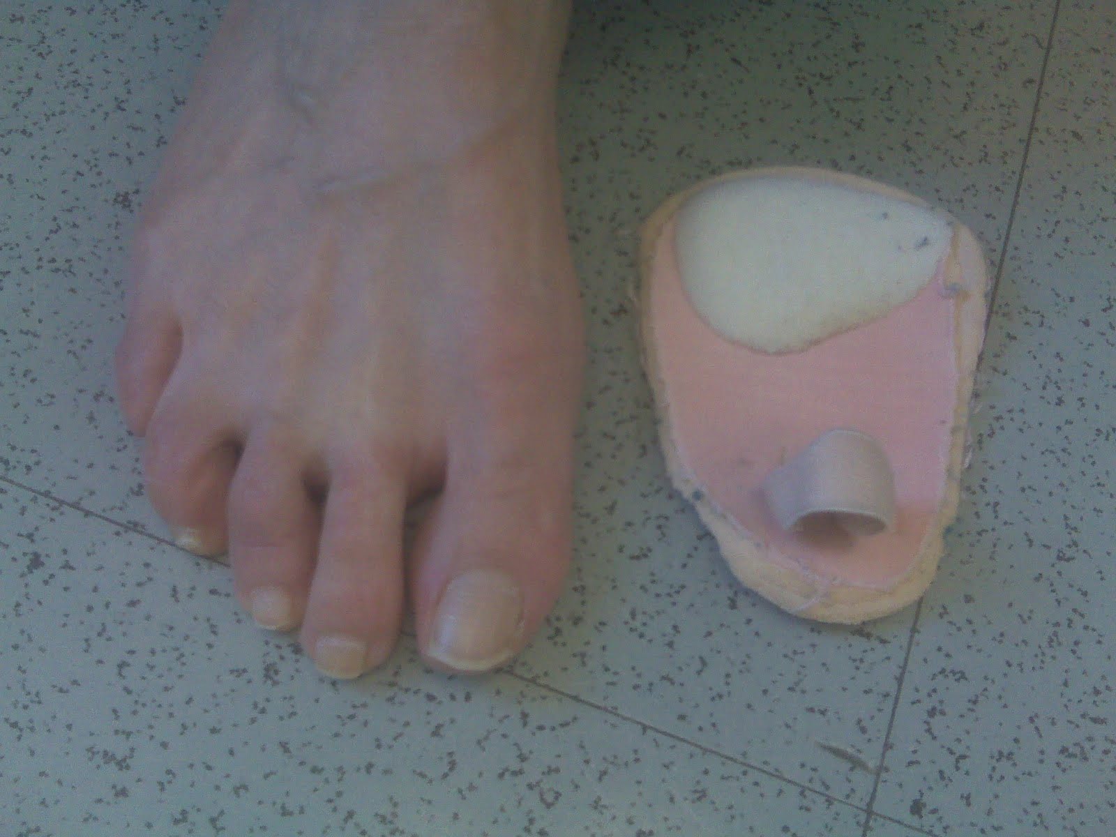 Treatment neuroma Options Morton's  Neuroma: for shoes www.drblakeshealingsole.com: