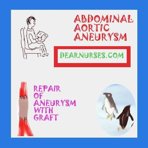 Abdominal aortic aneurysm physical exam picture