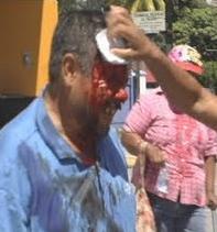 [Honduras+-+beaten+29+Oct.JPG]