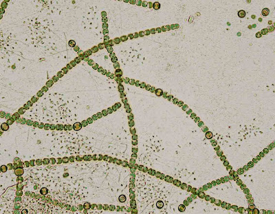Клетки водорослей и цианобактерий. Цианобактерии Анабена. Anabaena цианобактерия. Цинобактерия анабапна. Anabaena constricta.