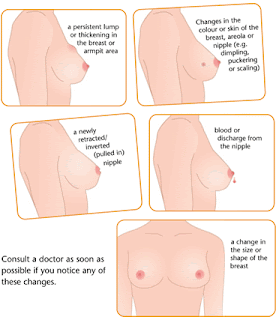 http://4.bp.blogspot.com/_BS1buYbxOEE/Rl7nCY6KDyI/AAAAAAAAAEE/i3cf0gEHHSY/s400/Breast+cancer.gif