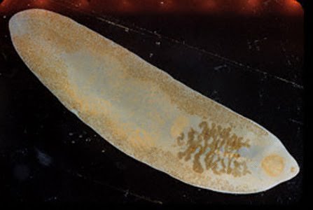 [Fasciolopsis_buski_adult_GA.jpg]