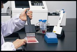 補体成分 4 検査の準備はどのようにすればよいですか?