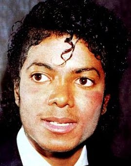 [MJ+vitiligo+4.jpg]