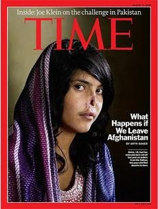 Aisha jovem de 18 anos que foi  sentenciada pelos Talibã a ter nariz e orelhas cortados