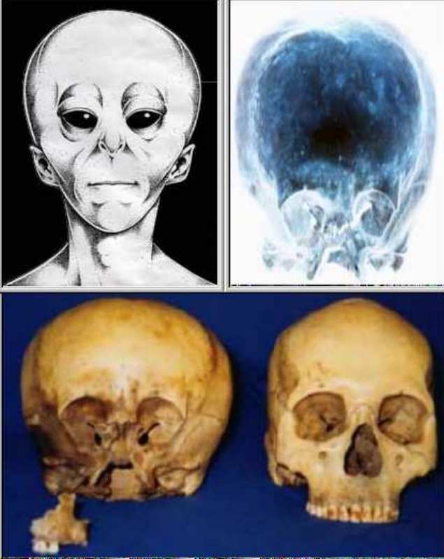 [starchild-skull-pictures.jpg]