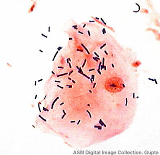 Microbiology Lactobacillus