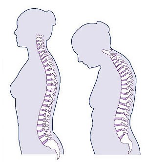 Cómo dolor detrás de la rodilla en 2 sencillos pasos?