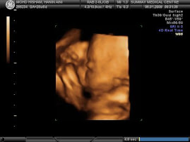 our baby inside my tummy