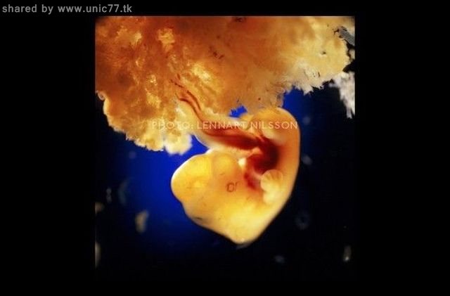 http://4.bp.blogspot.com/_EHi0bg7zYcQ/TIjbvAIRmoI/AAAAAAAAAmQ/YGIKgmlqgTw/s1600/the_mystery_of_pregnancy_12.jpg