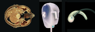 Binaural recording: NIH 'Virtual Human' head cross-section, Neuman KU100 'dummy head' binaural microphone (inverted image), Sound Professionals in-ear microphone (left ear)
