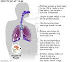 Effects of Anthrax