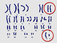 AP Biology Review: Autosomes and Sex Chromosomes