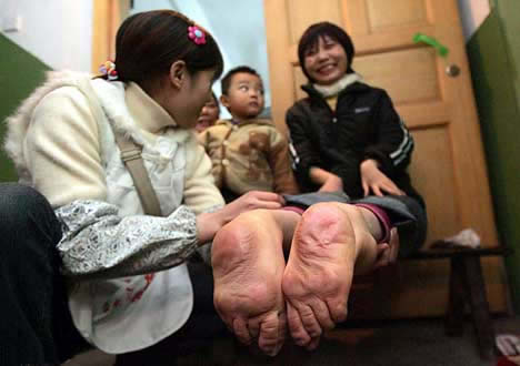 [a135_feetsback.jpg]